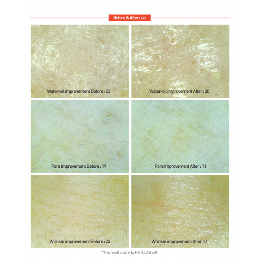 Centella Red Cream